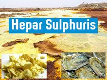 《靈丹妙藥的同類療法》- EP62 - 硫化鈣 Hepar Sulphuris
