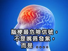 《自然療法與你》- EP804 - 腦梗最危險信號，不是嘴唇發紫，而是.........